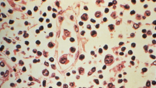 Hantavirus sur un bateau de croisi&egrave;re: un mode de transmission marginal favoris&eacute; par la promiscuit&eacute;