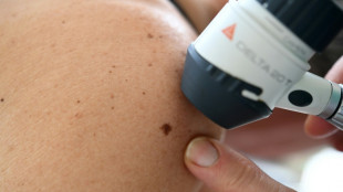 Cancers cutan&eacute;s: l'Anses alerte sur les risques li&eacute;s &agrave; l'exposition professionnelle aux rayons UV
