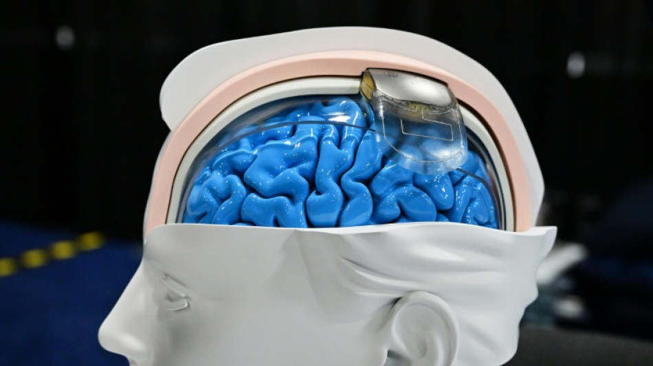 "Ya estamos en la ciencia ficci&oacute;n": la revoluci&oacute;n de la neurotecnolog&iacute;a